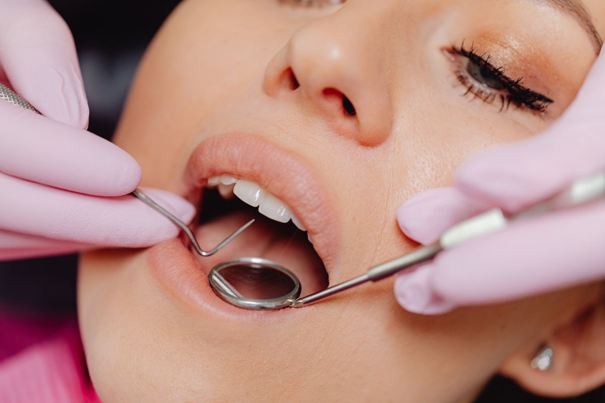 Close-up dental check-up to maintain a cosmetic smile