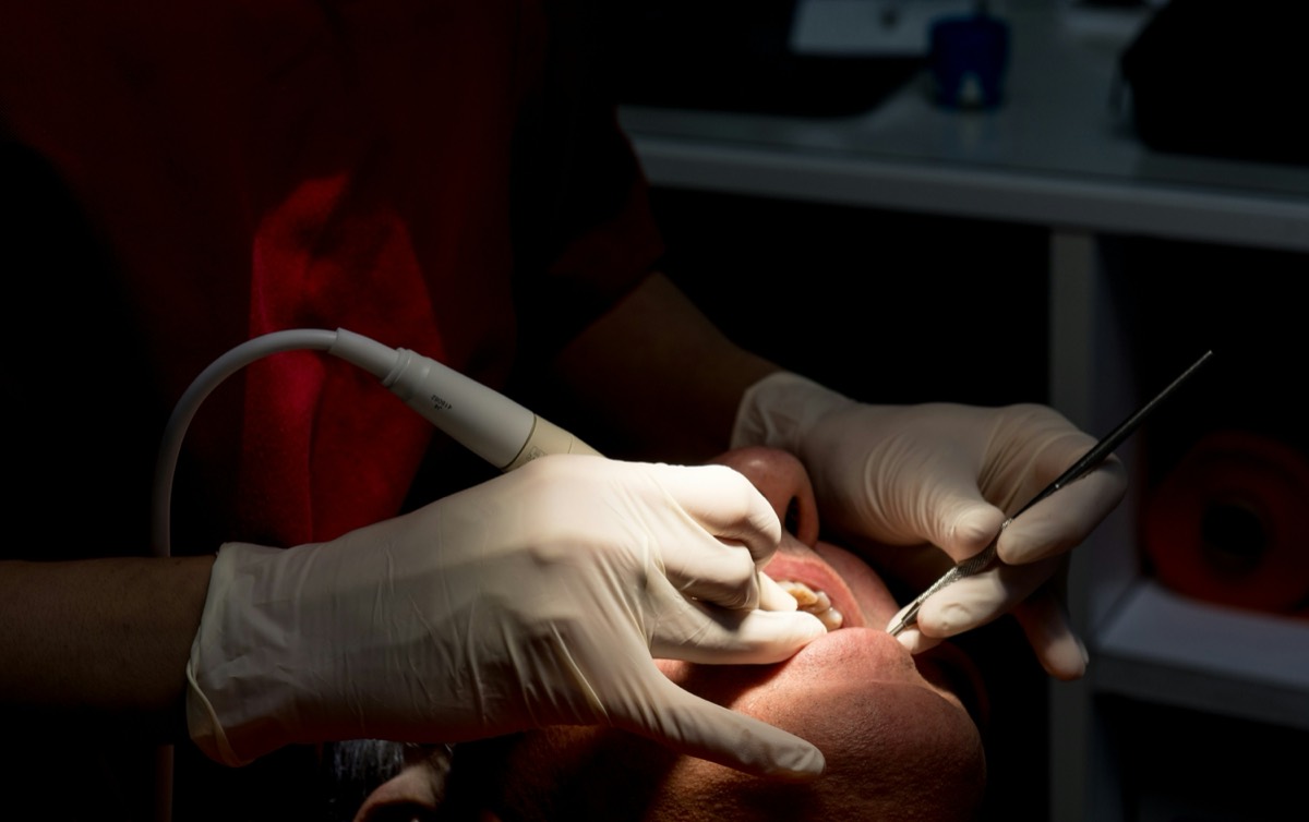 Dentist professionally cleaning teeth after dental implant treatment