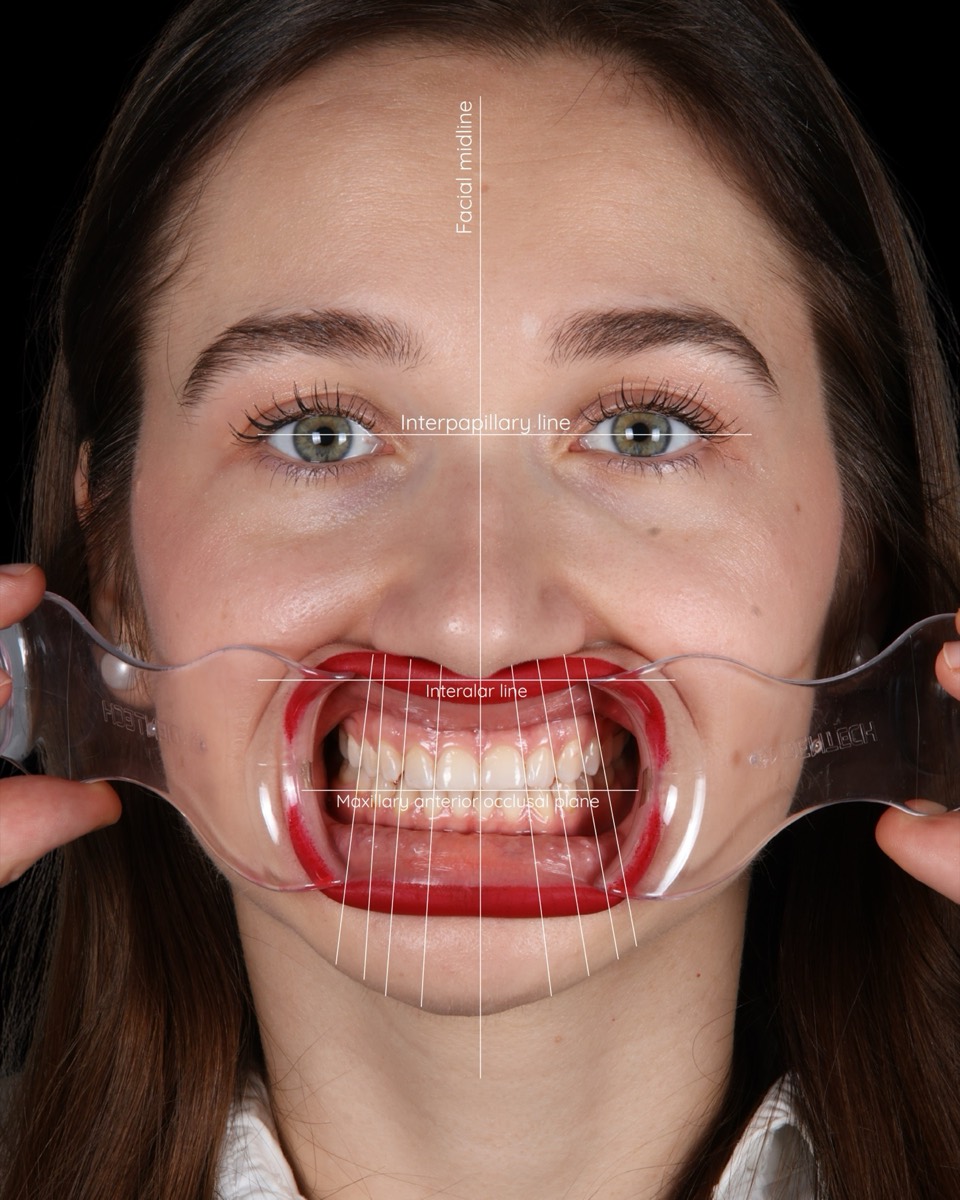 Smile Case 1 image 9