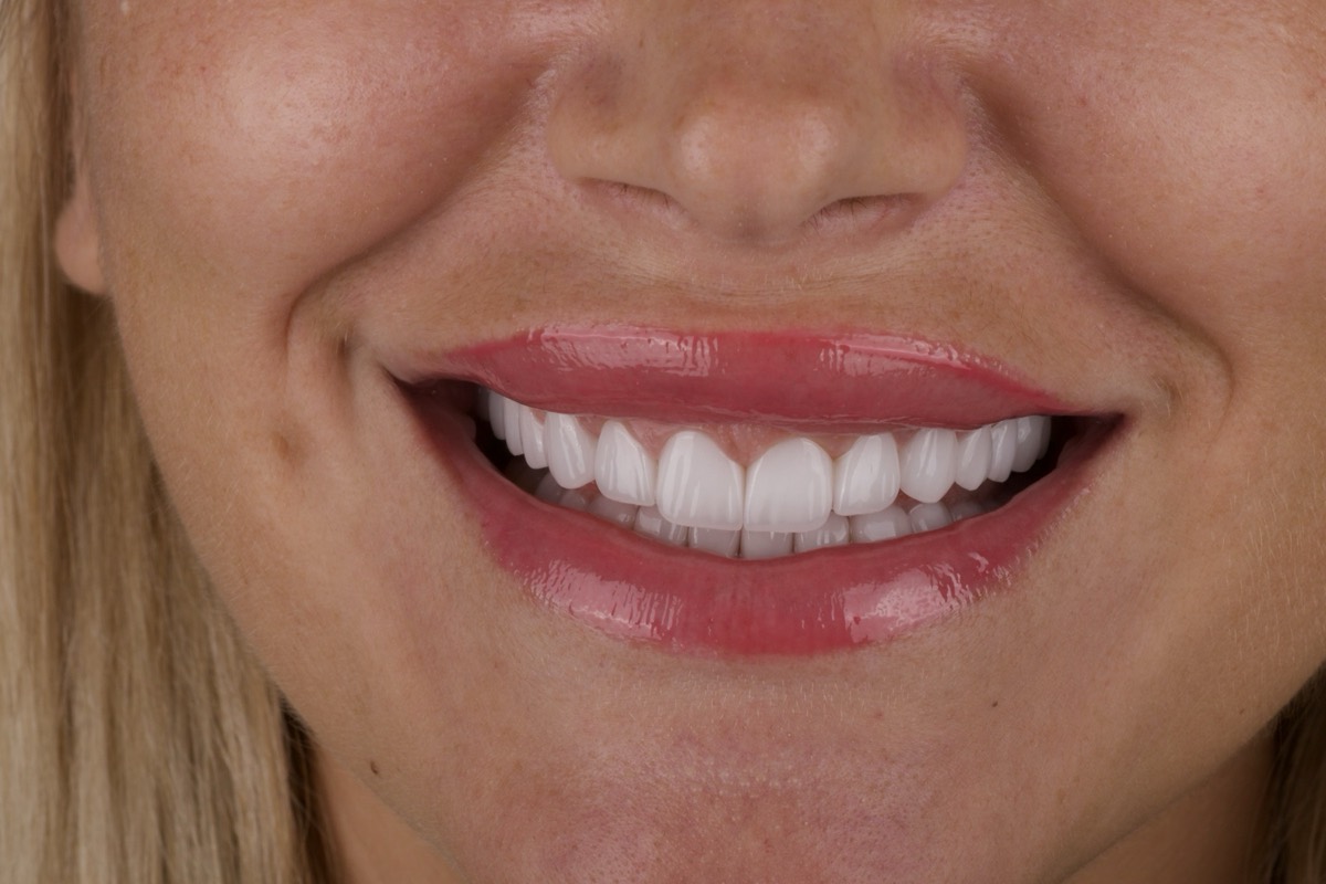 Smile Case 10 image 5