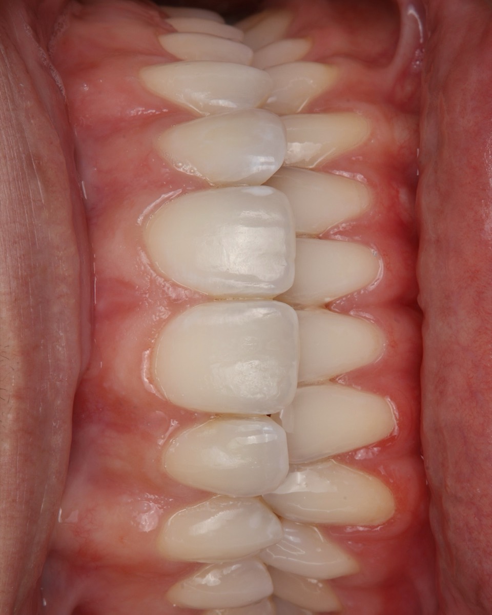 Smile Case 2 image 2