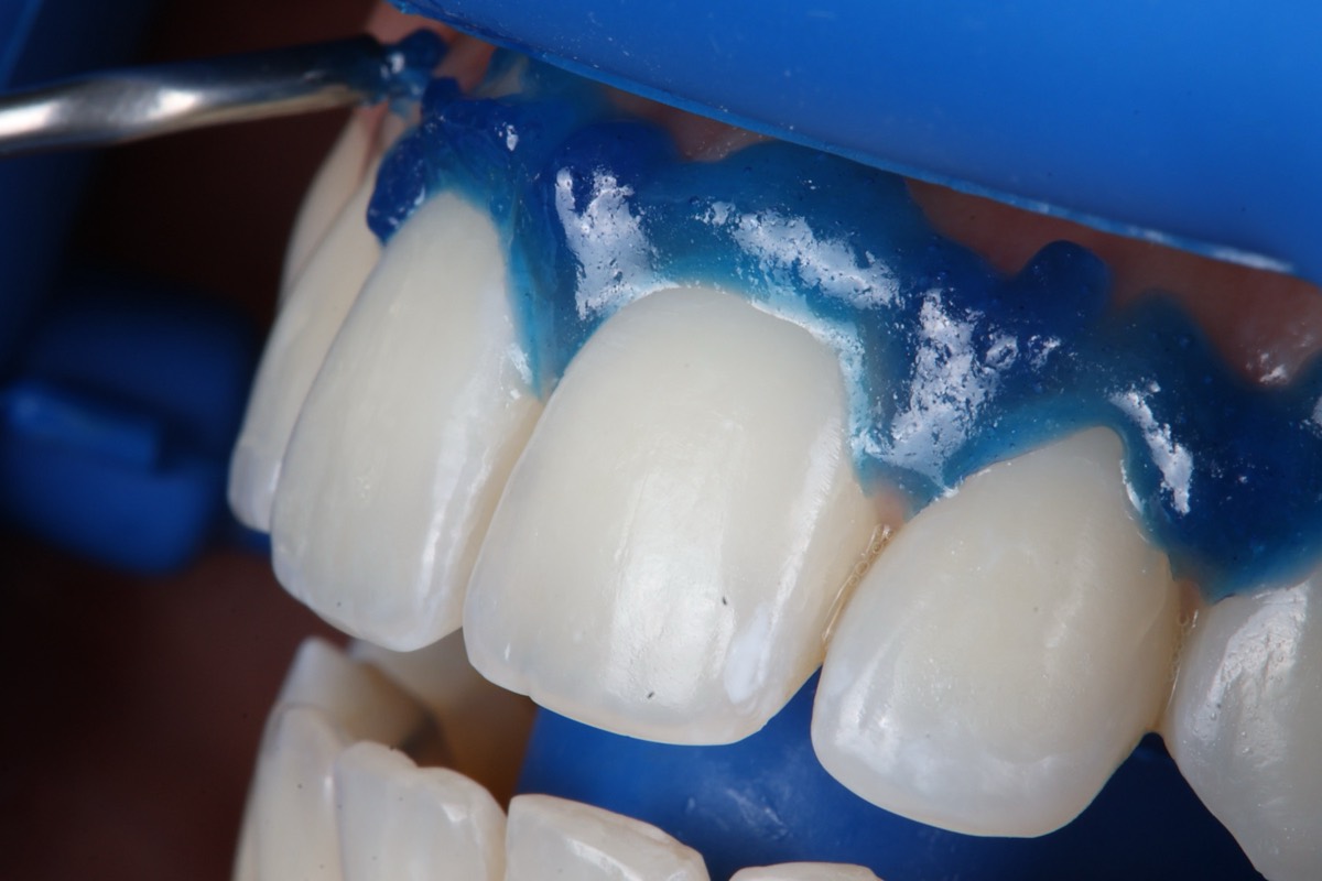 Smile Case 2 image 4