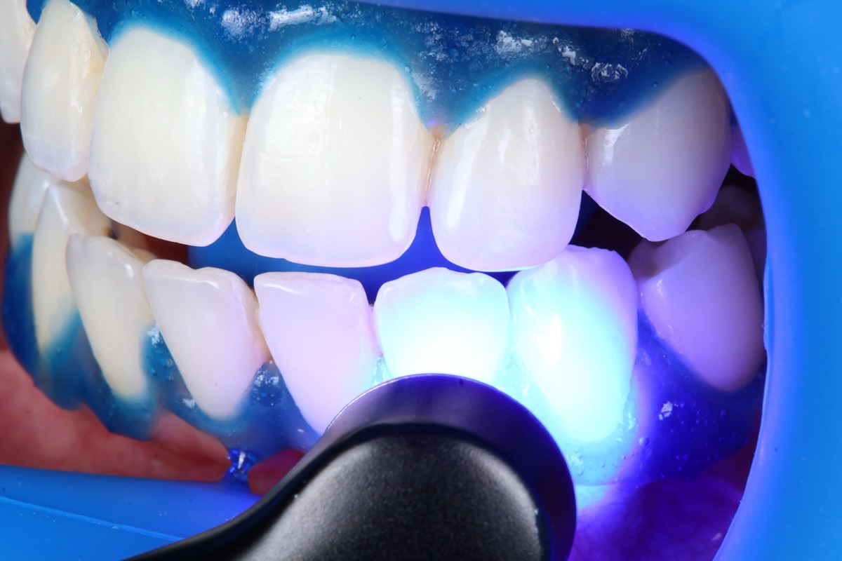 Smile Case 2 image 14