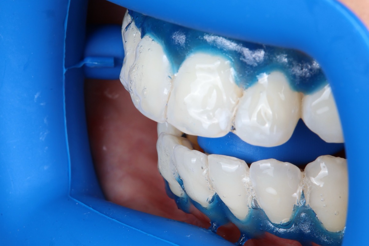 Smile Case 2 image 22