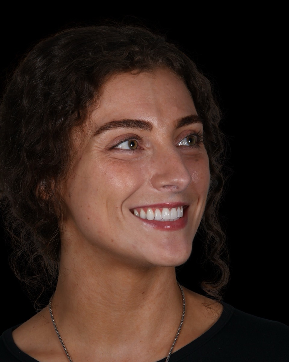 Smile Case 3 image 7