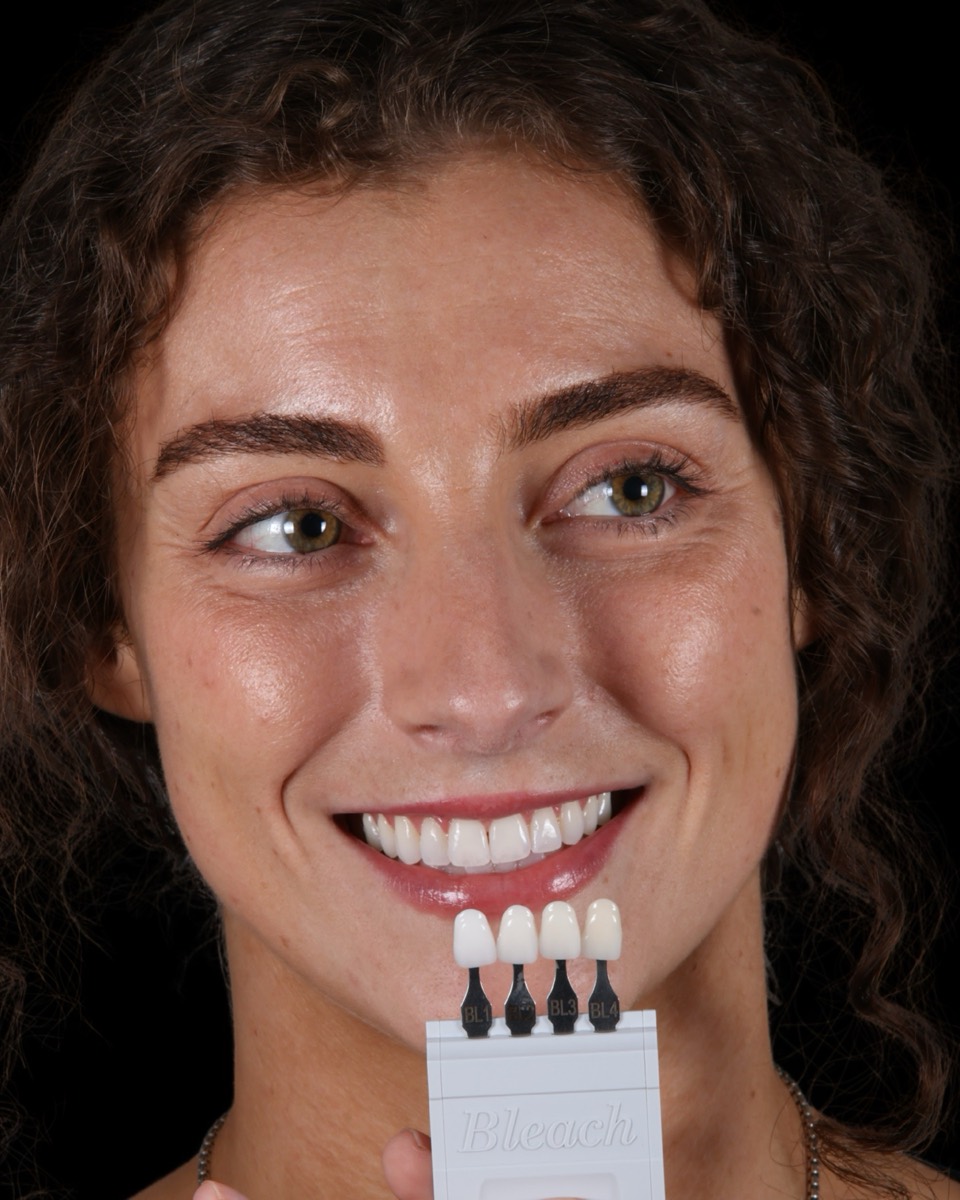 Smile Case 3 image 8