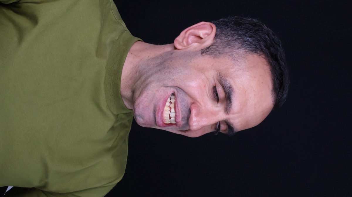 Smile Case 8 image 10