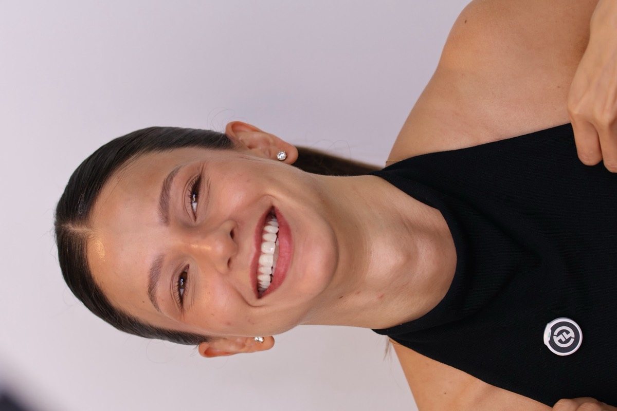 Smile Case 9 image 3